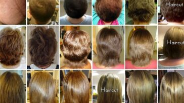 Does dairy cause hair growth?