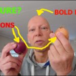 Does exercise help alopecia?