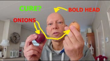 Does exercise help alopecia?