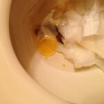 Does fish oil affect bowel movements?