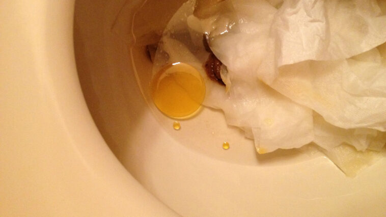 Does fish oil affect bowel movements?