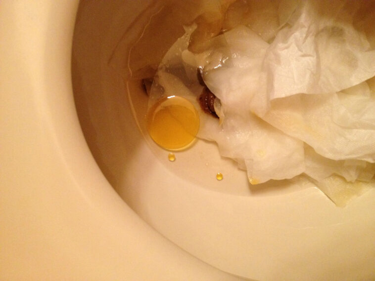 Does fish oil affect bowel movements?