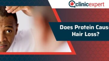 Does ideal protein cause hair loss?