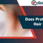 Does ideal protein cause hair loss?