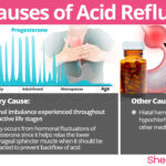 Does jalapeños cause acid reflux?