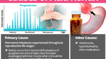 Does jalapeños cause acid reflux?