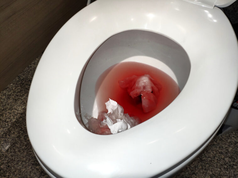 Does kidney taste like pee?