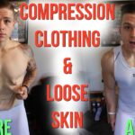 Does loose skin go away?