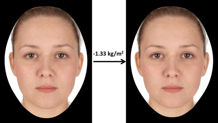 Does losing 20 pounds change your face?