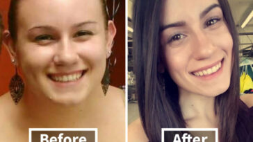 Does losing 30 pounds change your face?