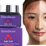 Does mayonnaise help with acne?