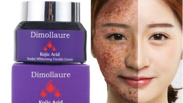 Does mayonnaise help with acne?