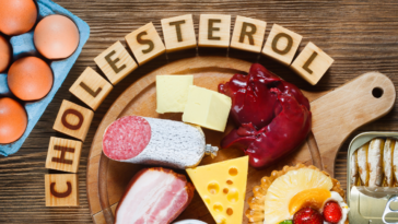 Does nutpods have cholesterol?