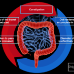 Does popcorn affect bowel movements?