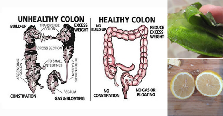 Does popcorn clean the colon?