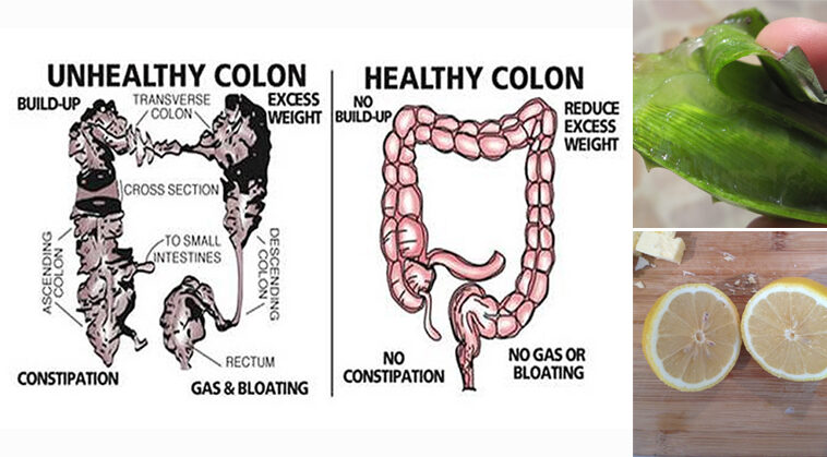 Does popcorn clean the colon?