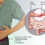 Does quinoa cause bowel movements?