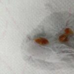 Does raisin bran help with bowel movement?