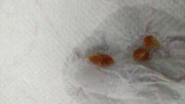 Does raisin bran help with bowel movement?