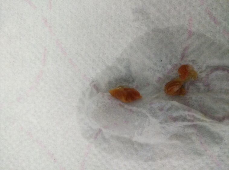 Does raisin bran help with bowel movement?