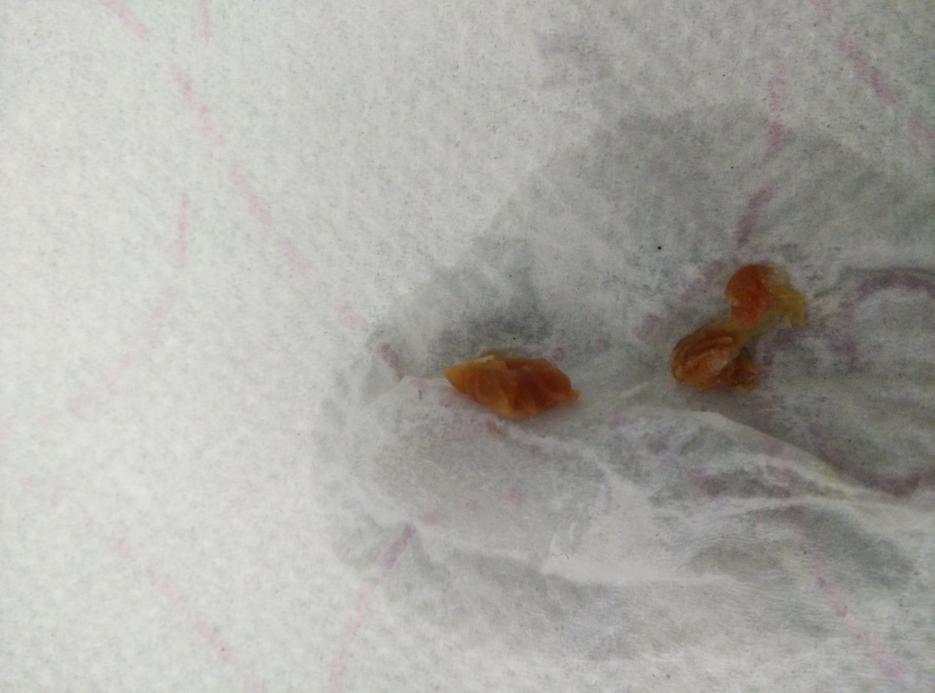 Helpen rozijnenzemelen bij de stoelgang?