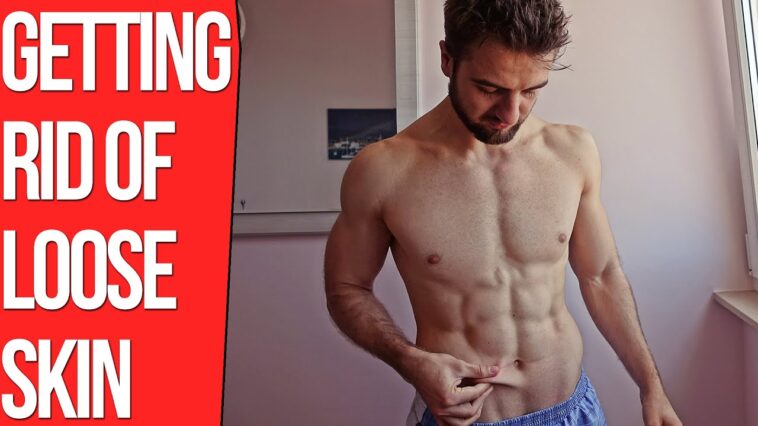 Does skin tighten after weight loss?