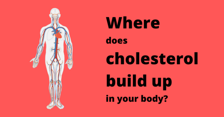 Does sucralose build up in your body?