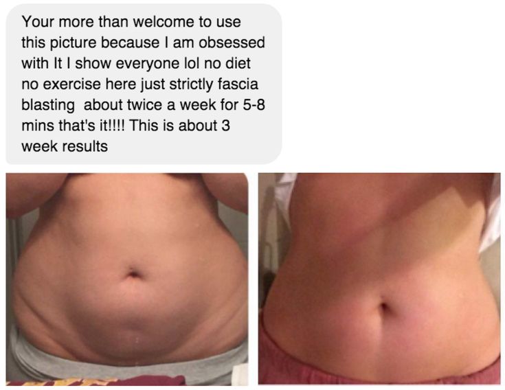 Does sucralose cause belly fat?