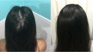 Does sugar help hair growth?