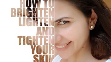 Does vitamin C tighten skin?