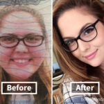 Does your face lose weight first?