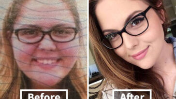 Does your face lose weight first?