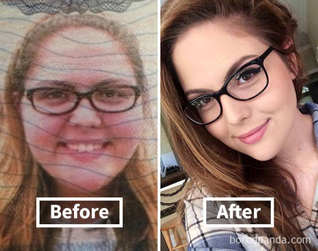Does your face lose weight first?
