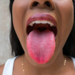 Does your tongue look weird with Covid?