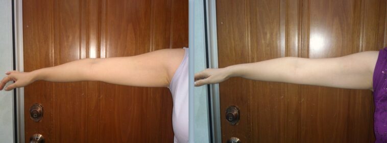 How can I firm my arms after 60?