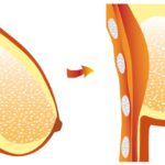 How can I firm my saggy breasts in a week?