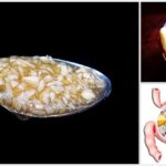 How can I flush out my intestines?