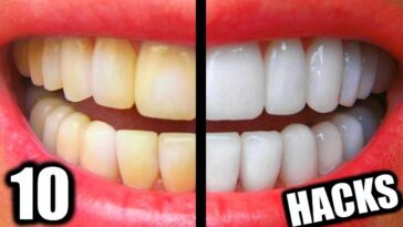 How can I get whiter teeth?