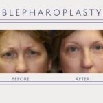 How can I look younger quickly?