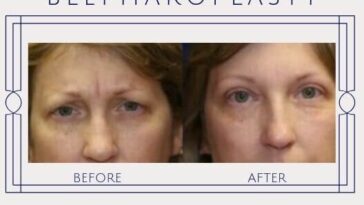 How can I look younger quickly?