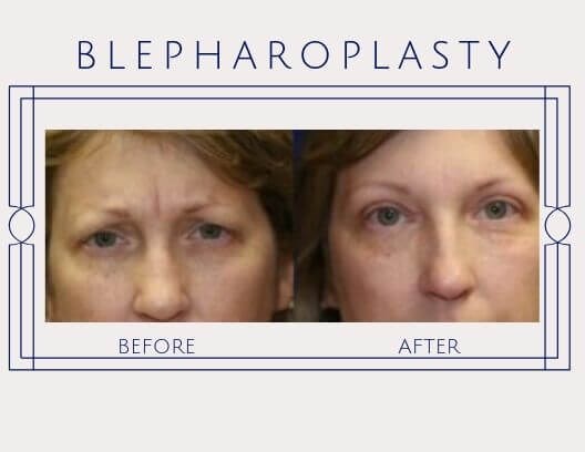 How can I look younger quickly?