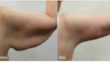 How can I lose my arm fat in 2 weeks?