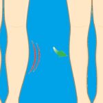 How can I slim my legs in 2 weeks?