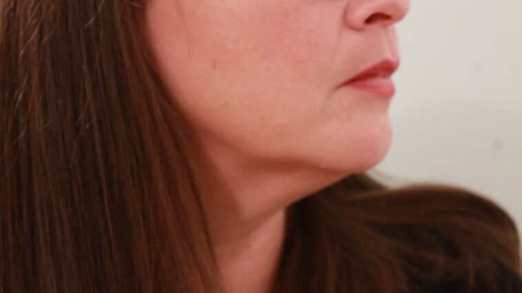 How can I tighten the skin under my chin?