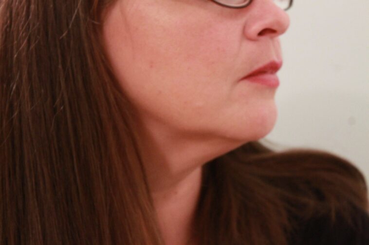 How can I tighten the skin under my chin?