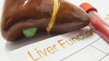How can you lower liver enzymes?