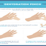 How can you tell if your dehydrated?