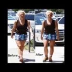 How did Britney Spears get rid of cellulite?