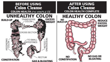 How do I cleanse my stomach to lose weight?