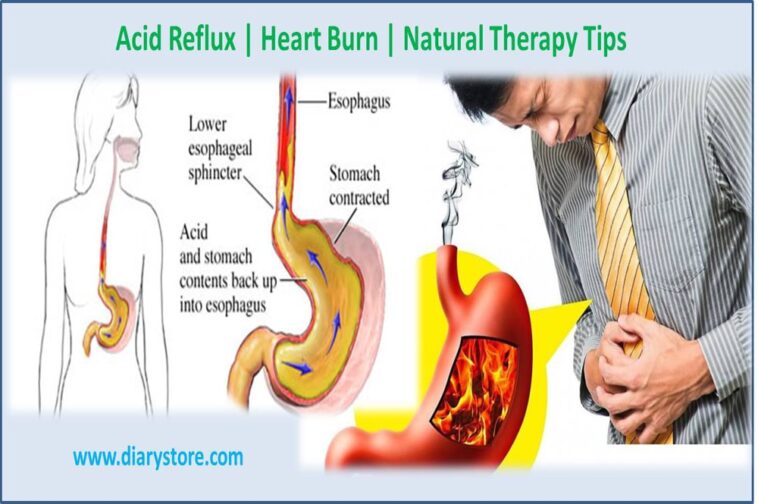 How do you calm acid reflux?